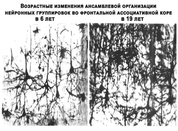 Организация обучения детей вдали от школ: экстернат, семейное образование и домашние…